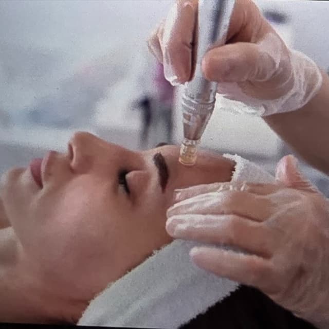 3 Microneedling Facials at JULES COSMETIC ARTISTRY in Omaha, NE